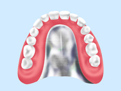 自費作製の入れ歯