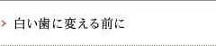 白い歯に変える前に