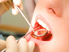 歯周病治療後のメインテナンスの重要性